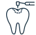 Dental Fillings