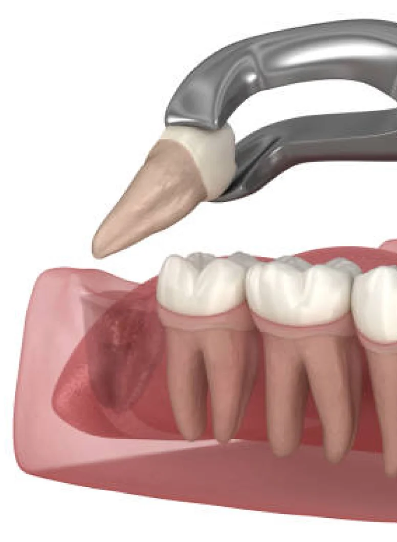 Dental Patient Smiling