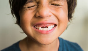 oakland child smiling with missing teeth